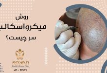 کاشت مو به روش میکرواسکالپ