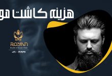 قیمت و هزینه کاشت مو
