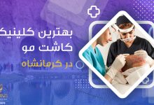 بهترین کلینیک کاشت مو در کرمانشاه