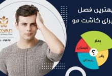 بهترین فصل برای عمل کاشت مو