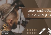 کوتاه کردن موها بعد از کاشت مو