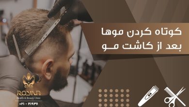 کوتاه کردن موها بعد از کاشت مو