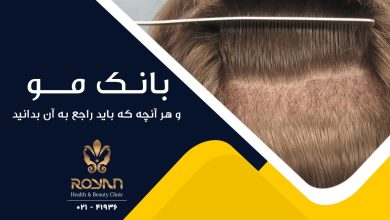 بانک مو و هر آنچه که باید راجع به آن بدانید