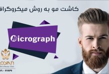 کاشت مو به روش میکروگرافت
