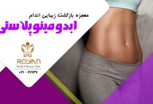ابدومینوپلاستی