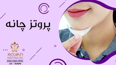 پروتز چانه