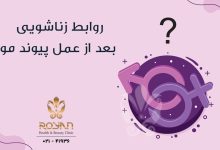 روابط زناشویی بعد از عمل پیوند مو