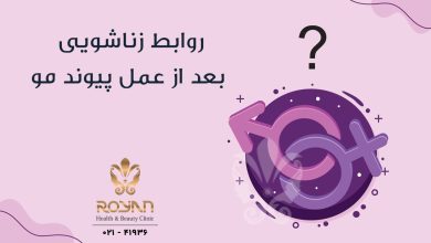روابط زناشویی بعد از عمل پیوند مو