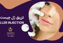 تزریق ژل چیست ؟