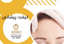 لیفت پیشانی