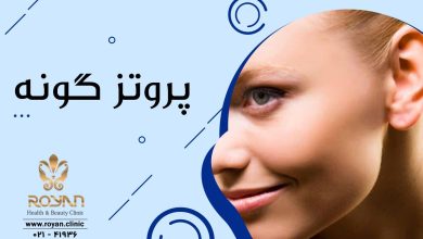 آشنایی با انواع روش های پروتز گونه