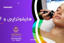 مقایسه هایفوتراپی صورت و آر اف فرکشنال