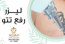 پاک کردن تاتو با لیزر