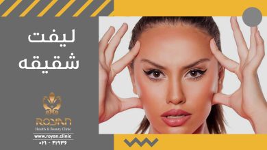 لیفت شقیقه