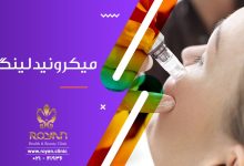 میکرونیدلینگ