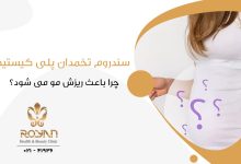 سندرم تخمدان پلی کیستیک