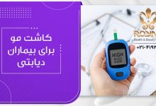 کاشت مو برای بیماران دیابتی
