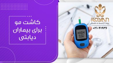 کاشت مو برای بیماران دیابتی