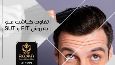 تفاوت کاشت موی FIT و SUT