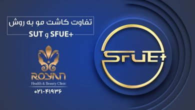 تفاوت کاشت موی SUPER FUE و SUT
