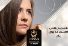 بهترین روش کاشت مو برای زنان