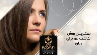 بهترین روش کاشت مو برای زنان