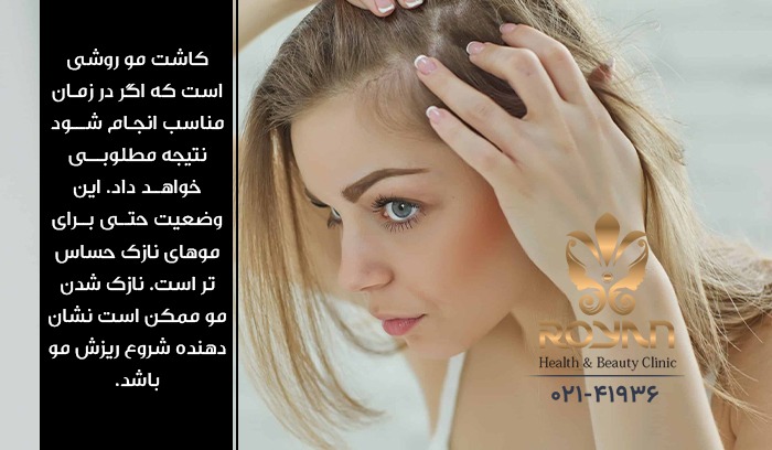 کاشت موی طبیعی برای زنان