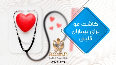 کاشت مو برای بیماران قلبی