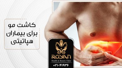 کاشت مو برای بیماران هپاتیتی
