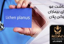کاشت مو برای بیماران لینکن پلان