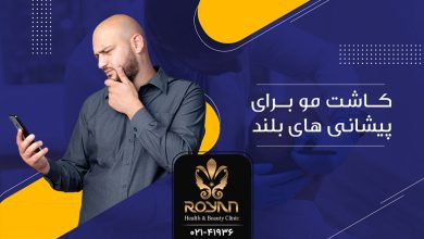 کاشت مو برای پیشانی های بلند