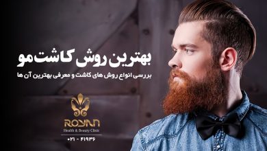 بهترین روش کاشت مو چیست ؟