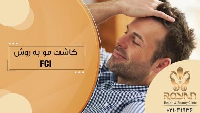 کاشت مو به روش FCI