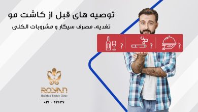مراقبت های قبل از کاشت مو