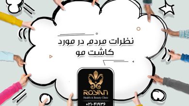 نظرات مردم در مورد کاشت مو