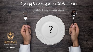 تغذیه بعد از کاشت مو