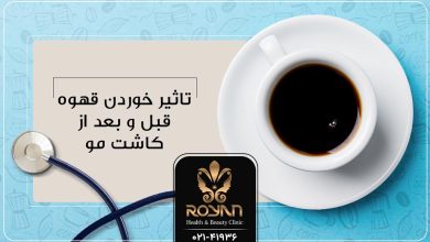 قهوه بعد از کاشت مو