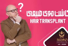 کاشت موی طبیعی