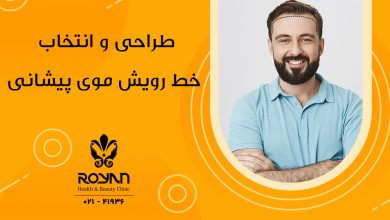طراحی خط رویش مو