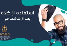 کلاه بعد از کاشت مو
