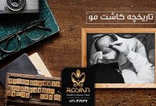 تاریخچه کاشت مو