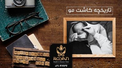 تاریخچه کاشت مو