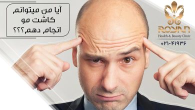 آیا من می توانم کاشت مو انجام دهم