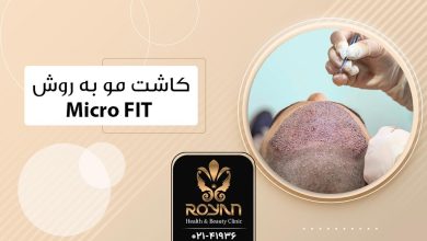 کاشت مو به روش میکرو FIT