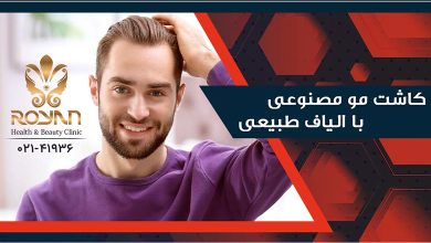 کاشت مو با الیاف نانو
