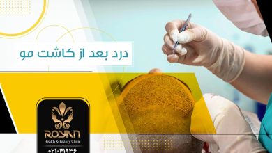 درد بعد از کاشت مو
