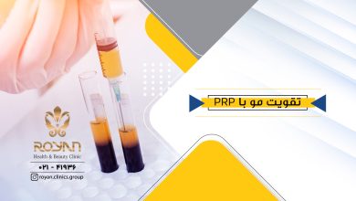 تقویت مو با PRP