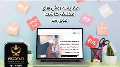 مقایسه روش های مختلف کاشت موی سر