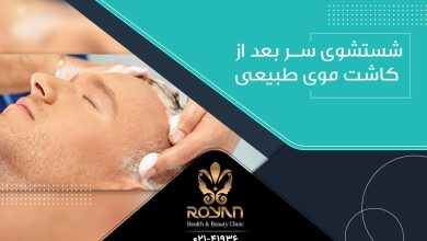شستشو بعد از کاشت مو
