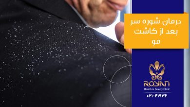شوره بعد از کاشت مو